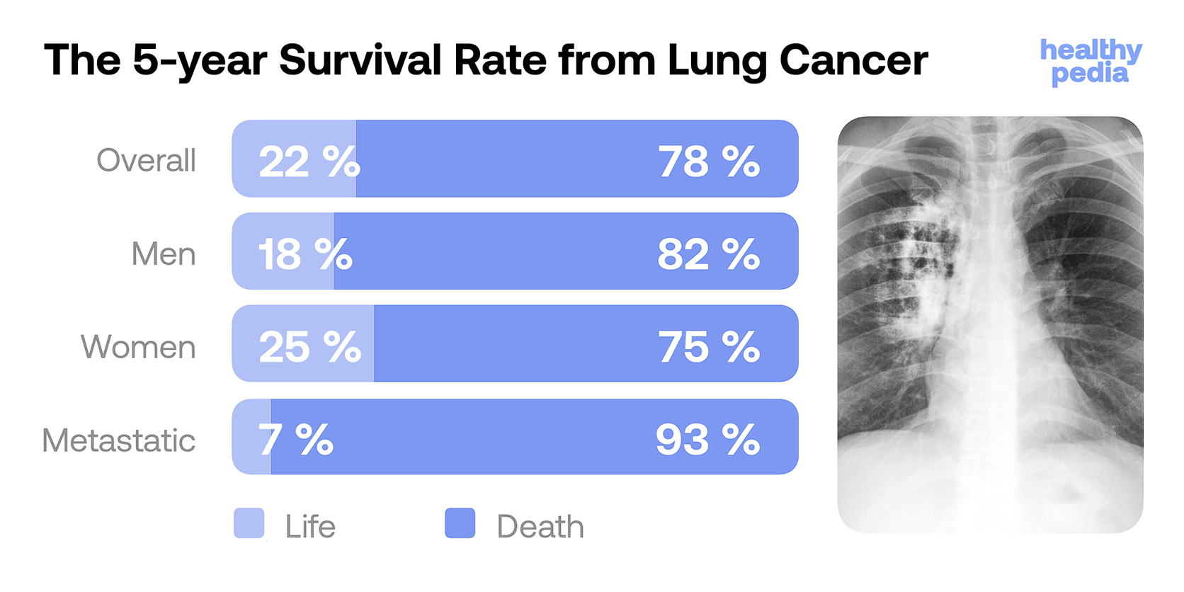 The 5-year Survival Rate from Lung Cancer, stats