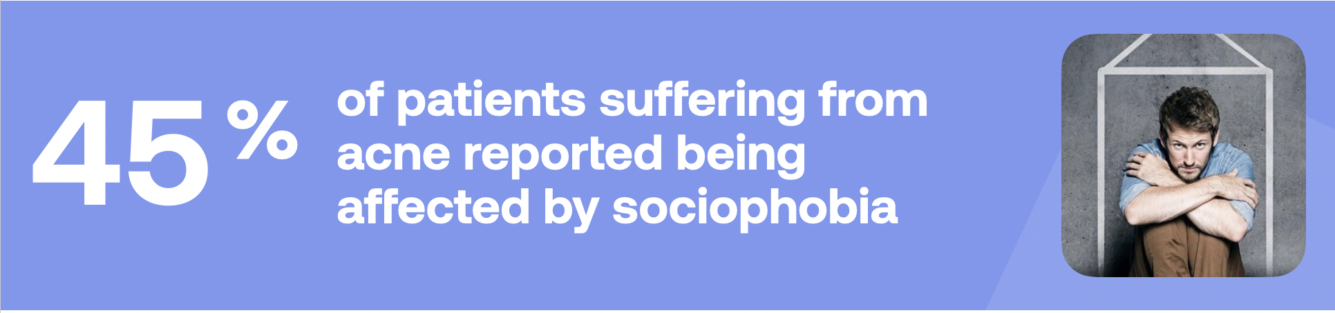 45% of patients suffering from acne reported being affected by sociophobia, stats